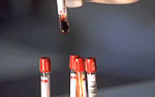 Медицинское обследование на вич-инфекцию