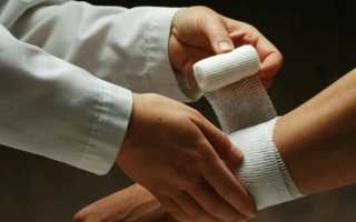 Производственный травматизм причины классификация профилактика