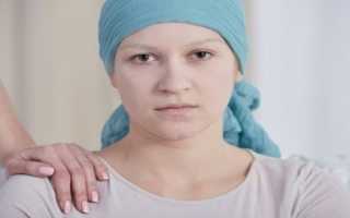 Какие льготы положены работающим онкологическим больным