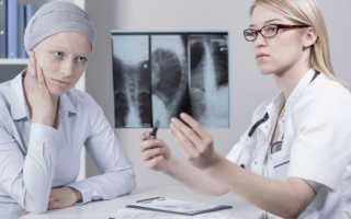 Кто такой онколог обязанности зарплата перспективы профессии