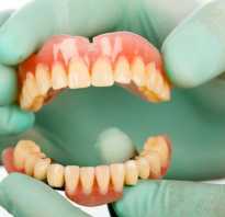 Льготное протезирование зубов в 2021 году